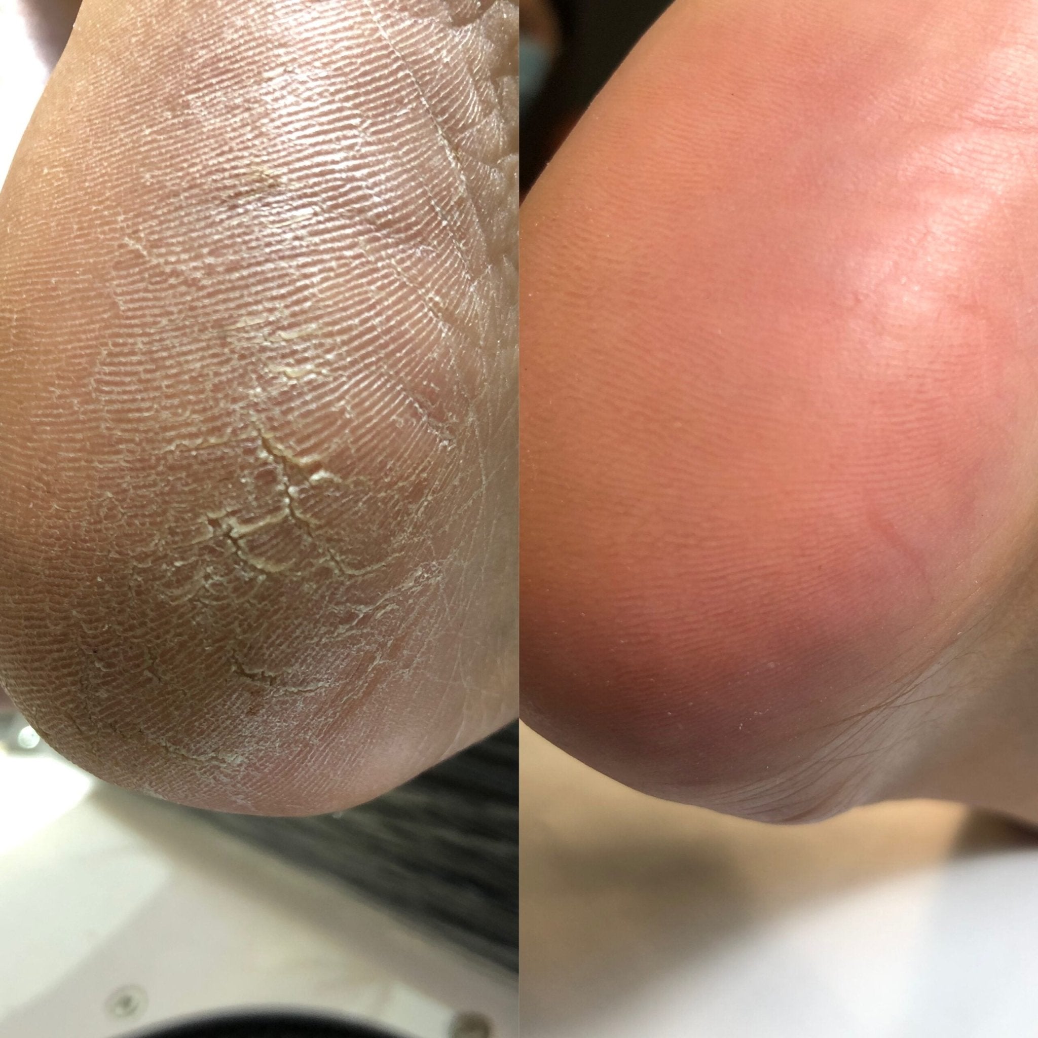 CALLUS REMOVER FOR Pedicure PODOLOGY BY NOTD 100ml (Physical item) - Nail Artistry Melbourne | Professional Nail Supplies Melbourne
